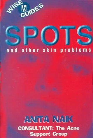 Cover image for Spots (Wise Guides)