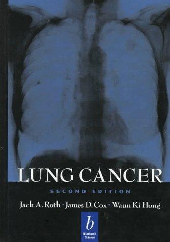 Cover image for Lung Cancer
