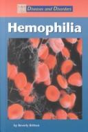 Cover image for Diseases and Disorders - Hepatitis (Diseases and Disorders)